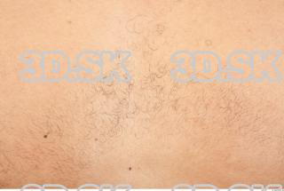 Skin texture of Waldo 0001